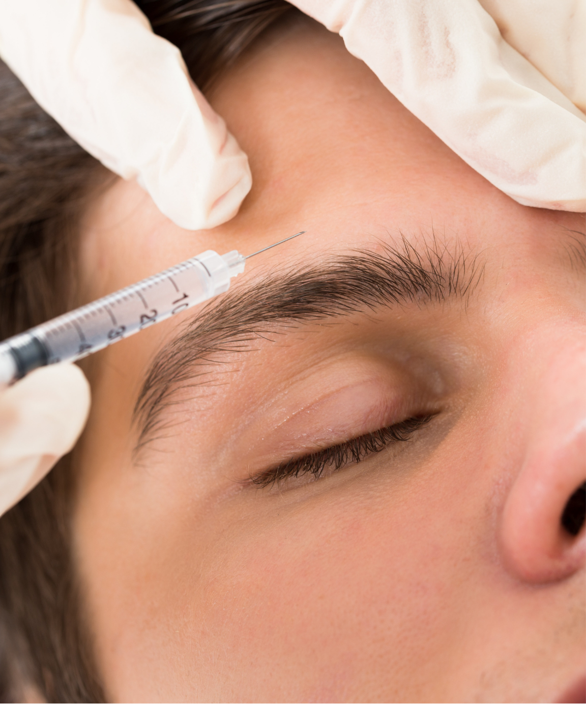Man getting an injectable treatment in his forehead