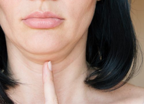Woman pointing at her double chin