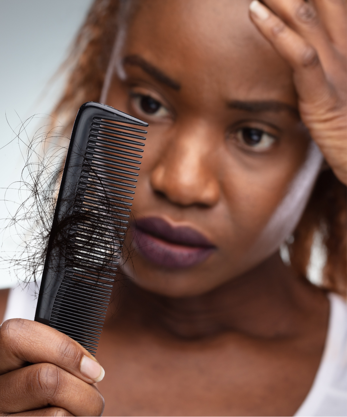 Woman experiencing hair loss